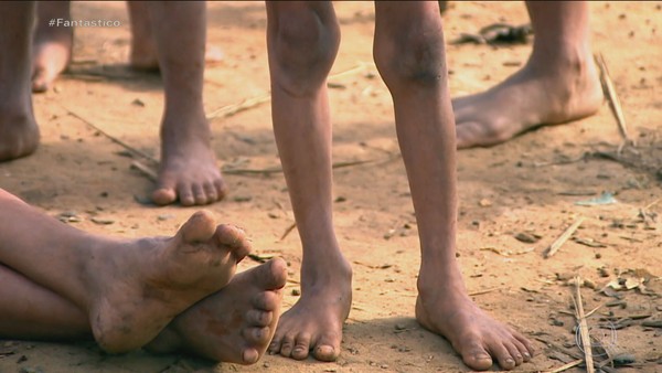 Nove crianças Yanomami morrem por falta de atendimento em dois meses, diz associação