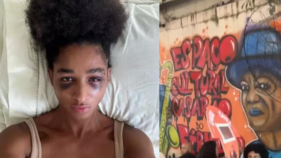 Mulher trans compartilha relato de agressão em casa de samba: “Incrédula com tanta violência que passei” 